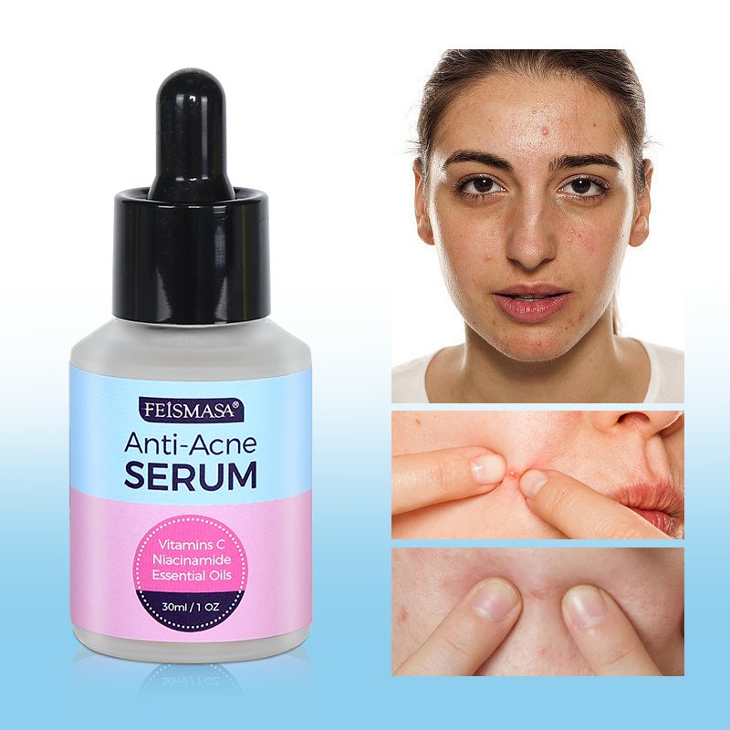 Sérum visage de traitement anti-acné et boutons - 4